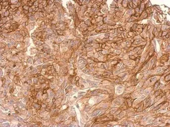 Anti-ADAMTSL2 antibody [C3], C-term used in IHC (Paraffin sections) (IHC-P). GTX102069
