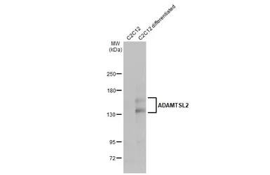 Anti-ADAMTSL2 antibody [C3], C-term used in Western Blot (WB). GTX102069