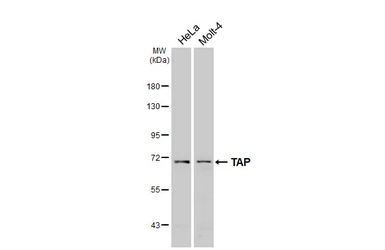 Anti-TAP antibody [N1N2], N-term used in Western Blot (WB). GTX102071
