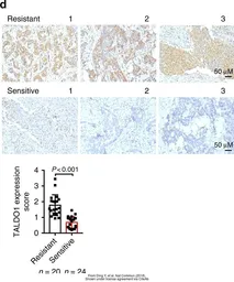 Anti-Transaldolase antibody used in IHC (Paraffin sections) (IHC-P). GTX102076