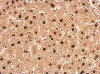 Anti-Transaldolase antibody used in IHC (Paraffin sections) (IHC-P). GTX102076