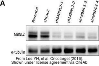 Anti-alpha Tubulin antibody used in Western Blot (WB). GTX102078