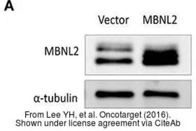 Anti-alpha Tubulin antibody used in Western Blot (WB). GTX102078
