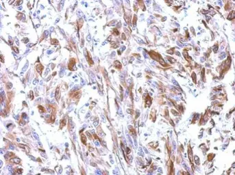 Anti-alpha Tubulin antibody used in IHC (Paraffin sections) (IHC-P). GTX102078