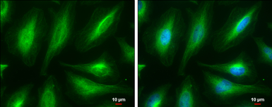 Anti-alpha Tubulin antibody used in Immunocytochemistry/ Immunofluorescence (ICC/IF). GTX102078