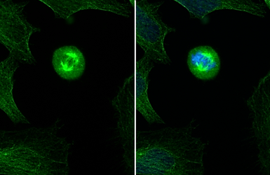 Anti-alpha Tubulin antibody used in Immunocytochemistry/ Immunofluorescence (ICC/IF). GTX102078
