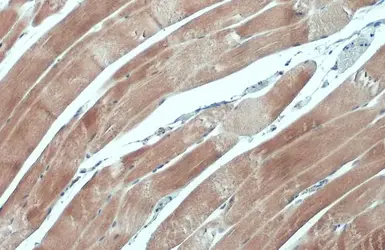 Anti-NFkB p65 antibody used in IHC (Paraffin sections) (IHC-P). GTX102090