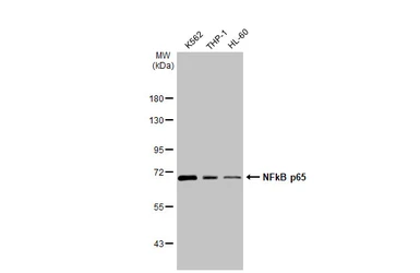 Anti-NFkB p65 antibody used in Western Blot (WB). GTX102090