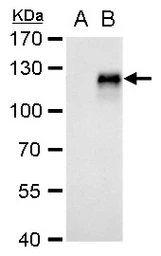 Anti-CD133 antibody [N1C1] used in Western Blot (WB). GTX102109