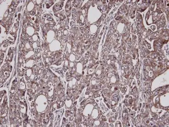 Anti-Lysyl-tRNA synthetase antibody used in IHC (Paraffin sections) (IHC-P). GTX102113