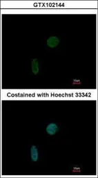 Anti-CIZ1 antibody [N2C1], Internal used in Immunocytochemistry/ Immunofluorescence (ICC/IF). GTX102144