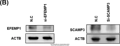 Anti-SCAMP3 antibody [N1N3] used in Western Blot (WB). GTX102216