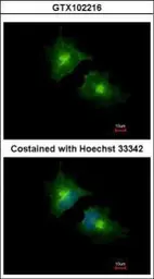 Anti-SCAMP3 antibody [N1N3] used in Immunocytochemistry/ Immunofluorescence (ICC/IF). GTX102216