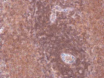 Anti-ARHGEF18 antibody used in IHC (Paraffin sections) (IHC-P). GTX102223