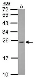 Anti-RPL13A antibody [N1C3] used in Western Blot (WB). GTX102228