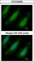 Anti-RPL13A antibody [N1C3] used in Immunocytochemistry/ Immunofluorescence (ICC/IF). GTX102228
