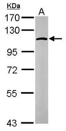 Anti-alpha Glucosidase II antibody [N1N2], N-term used in Western Blot (WB). GTX102237