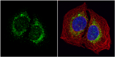 Anti-ORP150 antibody [C2C3], C-term used in Immunocytochemistry/ Immunofluorescence (ICC/IF). GTX102255