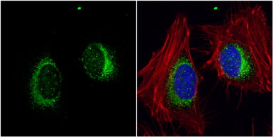 Anti-ORP150 antibody [C2C3], C-term used in Immunocytochemistry/ Immunofluorescence (ICC/IF). GTX102255