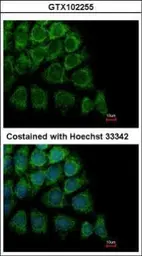 Anti-ORP150 antibody [C2C3], C-term used in Immunocytochemistry/ Immunofluorescence (ICC/IF). GTX102255