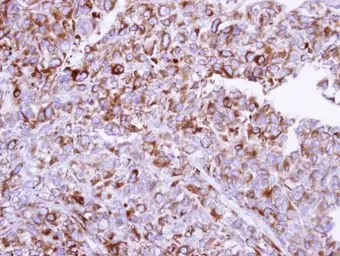 Anti-ORP150 antibody [C2C3], C-term used in IHC (Paraffin sections) (IHC-P). GTX102255