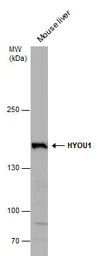Anti-ORP150 antibody [C2C3], C-term used in Western Blot (WB). GTX102255