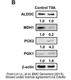 Anti-Aldolase C antibody [N1C1] used in Western Blot (WB). GTX102284
