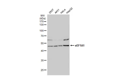 Anti-eEF1A1 antibody [N1C1] used in Western Blot (WB). GTX102285