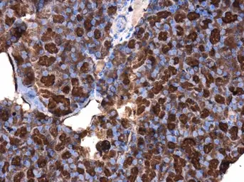 Anti-CDC25A antibody used in IHC (Paraffin sections) (IHC-P). GTX102308
