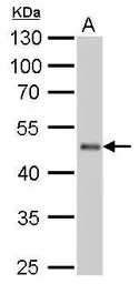Anti-EEF1A2 antibody used in Western Blot (WB). GTX102326