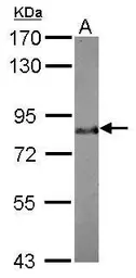 Anti-BAG3 antibody [N1C1] used in Western Blot (WB). GTX102343