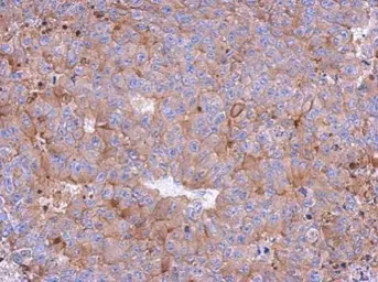 Anti-Calpain 1 antibody used in IHC (Paraffin sections) (IHC-P). GTX102350