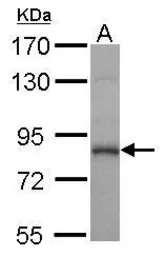 Anti-Calpain 1 antibody used in Western Blot (WB). GTX102350