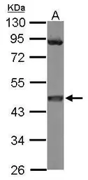 Anti-MEK1 antibody used in Western Blot (WB). GTX102391