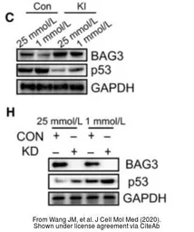 Anti-BAG3 antibody used in Western Blot (WB). GTX102396