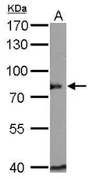 Anti-BAG3 antibody used in Western Blot (WB). GTX102396