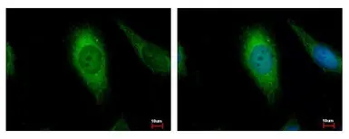 Anti-AIF antibody [N1N2], N-term used in Immunocytochemistry/ Immunofluorescence (ICC/IF). GTX102399