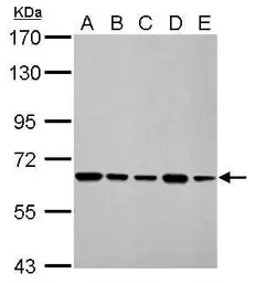 Anti-AIF antibody [N1N2], N-term used in Western Blot (WB). GTX102399