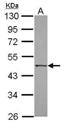 Anti-DAP Kinase 3 antibody used in Western Blot (WB). GTX102404