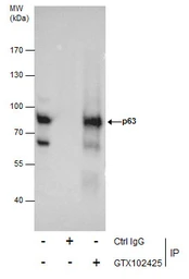 Anti-p63 antibody [N2C1], Internal used in Immunoprecipitation (IP). GTX102425