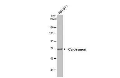 Anti-Caldesmon antibody [N1N2], N-term used in Western Blot (WB). GTX102498