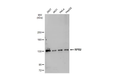 Anti-RPB2 antibody [N1], N-term used in Western Blot (WB). GTX102535