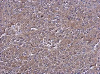 Anti-PTPN12 antibody [N1N2], N-term used in IHC (Paraffin sections) (IHC-P). GTX102542