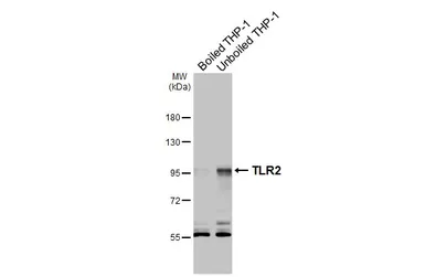 Anti-TLR2 antibody [N1N2], N-term used in Western Blot (WB). GTX102577