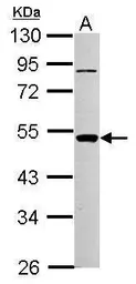 Anti-PIGA antibody used in Western Blot (WB). GTX102597