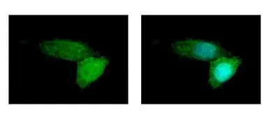 Anti-BSEP antibody [N3C1], Internal used in Immunocytochemistry/ Immunofluorescence (ICC/IF). GTX102608
