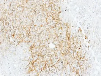 Anti-BSEP antibody [N3C1], Internal used in IHC (Paraffin sections) (IHC-P). GTX102608