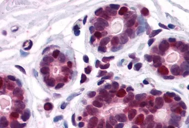 Anti-DDX5 antibody, C-term used in IHC (Paraffin sections) (IHC-P). GTX10261