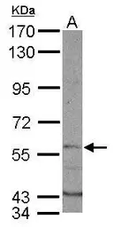 Anti-DYRK1B antibody used in Western Blot (WB). GTX102623