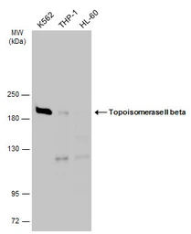Anti-Topoisomerase II beta antibody [C3], C-term used in Western Blot (WB). GTX102640